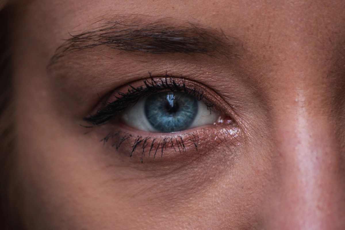 Fine Lines & Wrinkles