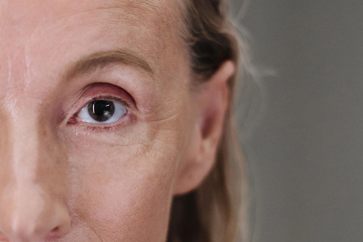 Mature Skin
