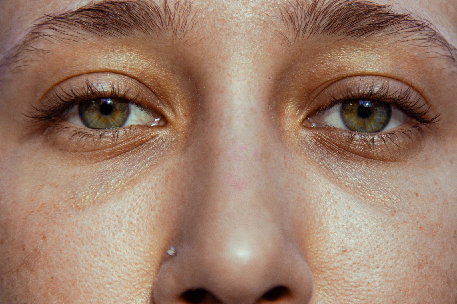 Dry Scaly Under Eye